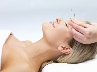 acupuntura-clinica-speciallita-400x300 Acupuncture therapy - alternative medicine  