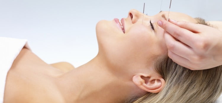 acupuntura-clinica-speciallita-750x350 Acupuntura  